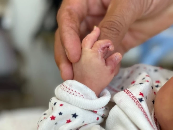 Prematüre Bebek Hastanede Sakatlandı İddiası