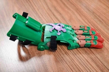Büyükşehir çocuklara robot el ile umut olacak
